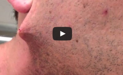 Man shaves his beard off but he got terrified when he found out...