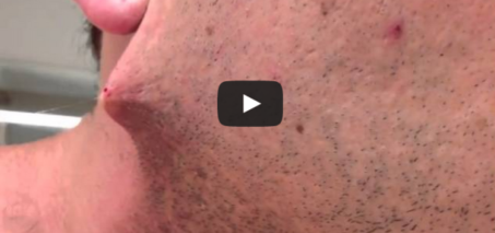 Man shaves his beard off but he got terrified when he found out...