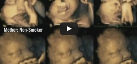 4D scans show how harmful smoking is on unborn babies