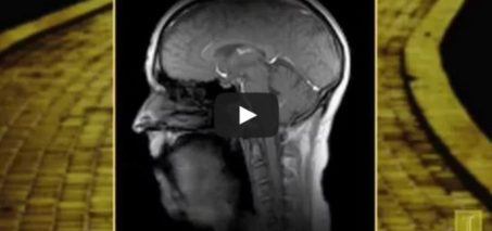 New Super-Fast MRI Technique: Singing 'If I Only Had a Brain'